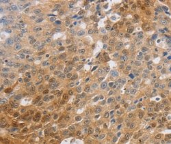 Invitrogen MCT2 Polyclonal Antibody 100 &mu;L | Buy Online | Invitrogen&trade; | Fisher Scientific