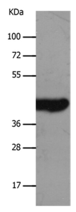 Invitrogen MCT2 Polyclonal Antibody 100 &mu;L | Buy Online | Invitrogen&trade; | Fisher Scientific