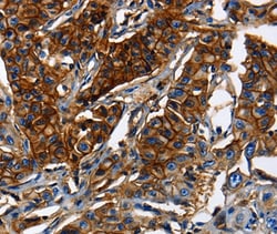 Invitrogen MRP5 Polyclonal Antibody 100 &mu;L; Unconjugated:Antibodies,