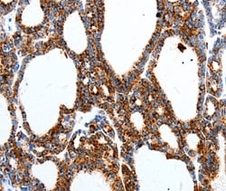 Invitrogen MTNR1A Polyclonal Antibody 100 &mu;L; Unconjugated:Antibodies,