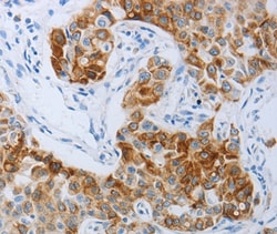 P2Y4 Polyclonal Antibody:Antibodies, Polyclonal
