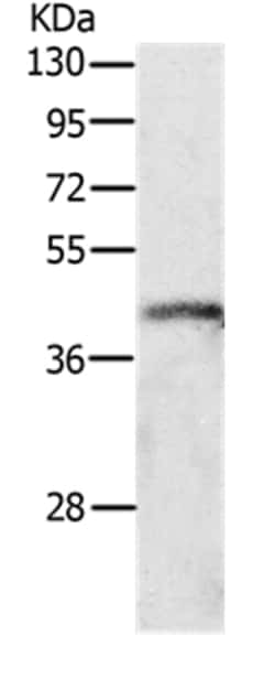 Invitrogen P2Y4 Polyclonal Antibody 100 &mu;L; Unconjugated:Antibodies,