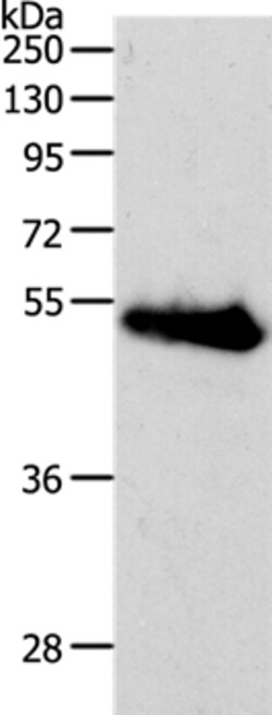 Invitrogen RBMS3 Polyclonal Antibody 100 &mu;L; Unconjugated:Anticuerpos