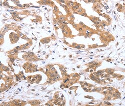 Invitrogen PSPN Polyclonal Antibody 100 &mu;L; Unconjugated:Antibodies,