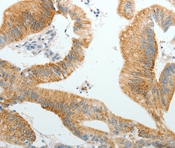 Invitrogen PGBD5 Polyclonal Antibody 100 &mu;L; Unconjugated:Antibodies,