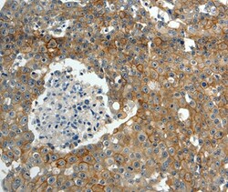 Invitrogen MRP7 Polyclonal Antibody 100 &mu;L; Unconjugated:Antibodies,