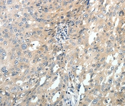 Invitrogen MRP7 Polyclonal Antibody 100 &mu;L; Unconjugated:Antibodies,