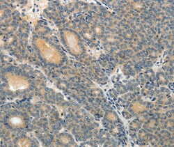 Invitrogen MRP9 Polyclonal Antibody 100 &mu;L; Unconjugated:Antibodies,