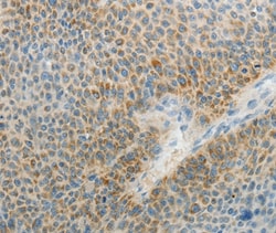 Invitrogen AGAP1 Polyclonal Antibody 100 &mu;L; Unconjugated:Antibodies,