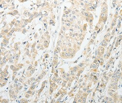 Invitrogen CCP4 Polyclonal Antibody 100 &mu;L; Unconjugated:Antibodies,