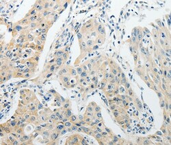 Invitrogen CCP4 Polyclonal Antibody 100 &mu;L; Unconjugated:Antibodies,