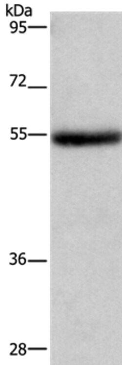 Invitrogen LPCAT4 Polyclonal Antibody 100 &mu;L; Unconjugated:Antibodies,