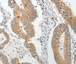 Invitrogen AKAP1 Polyclonal Antibody 100 &mu;L; Unconjugated:Antibodies,