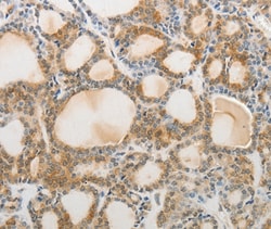 Invitrogen AKAP1 Polyclonal Antibody 100 &mu;L; Unconjugated:Antibodies,