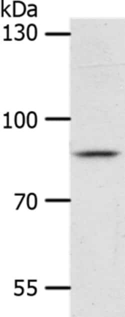 Invitrogen ANKRD28 Polyclonal Antibody 100 &mu;L; Unconjugated:Antibodies,