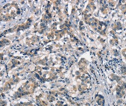 Invitrogen APOA1BP Polyclonal Antibody 100 &mu;L; Unconjugated:Antibodies,