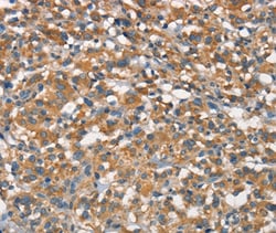 Invitrogen APOA1BP Polyclonal Antibody 100 &mu;L; Unconjugated:Antibodies,