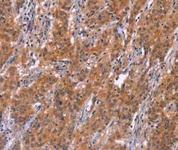 Invitrogen ARPC4 Polyclonal Antibody 100 &mu;L; Unconjugated:Antibodies,