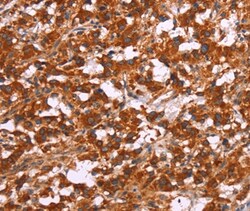 Invitrogen ARPC4 Polyclonal Antibody 100 &mu;L; Unconjugated:Antibodies,