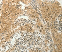 SLC8A3 Polyclonal Antibody:Antibodies, Polyclonal