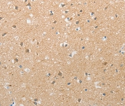 Invitrogen TACR2 Polyclonal Antibody 100 &mu;L; Unconjugated:Antibodies,