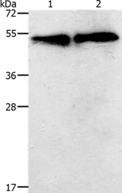 Invitrogen TACR2 Polyclonal Antibody 100 &mu;L | Buy Online | Invitrogen&trade; | Fisher Scientific