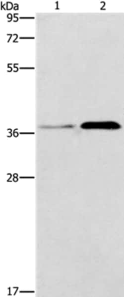 Invitrogen PAFAH2 Polyclonal Antibody 100 &mu;L; Unconjugated:Antibodies,