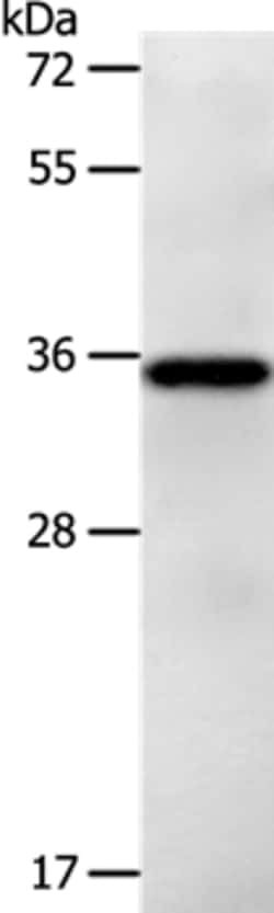 Invitrogen LPPR5 Polyclonal Antibody 100 &mu;L | Buy Online | Invitrogen&trade; | Fisher Scientific
