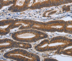 Invitrogen PDGF-A Polyclonal Antibody 100 &mu;L | Buy Online | Invitrogen&trade; | Fisher Scientific