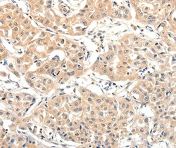 SLC27A1 Polyclonal Antibody:Antibodies, Polyclonal