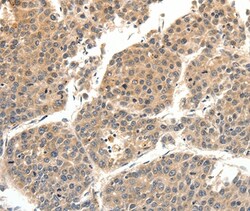 SLC27A1 Polyclonal Antibody:Antibodies, Polyclonal