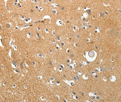 Invitrogen AKAP12 Polyclonal Antibody 100 &mu;L; Unconjugated:Antibodies,