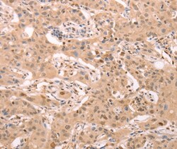 Invitrogen STRA8 Polyclonal Antibody 100 &mu;L; Unconjugated:Antikörper