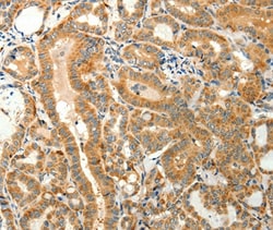 Invitrogen TMSB4X Polyclonal Antibody 100 &mu;L; Unconjugated:Antibodies,