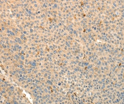 Invitrogen TMSB4X Polyclonal Antibody 100 &mu;L; Unconjugated:Antibodies,