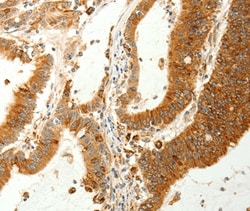 Invitrogen RARRES1 Polyclonal Antibody 100 &mu;L; Unconjugated:Antibodies,