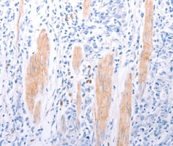EDG4 Polyclonal Antibody:Antibodies, Polyclonal