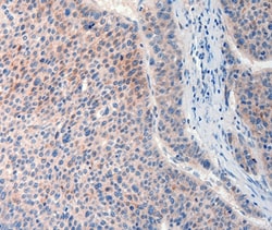 FAT4 Polyclonal Antibody:Antibodies, Polyclonal