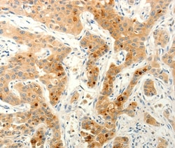 FAT4 Polyclonal Antibody:Antibodies, Polyclonal