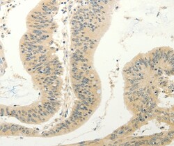FZD8 Polyclonal Antibody:Antibodies, Polyclonal