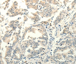 FZD8 Polyclonal Antibody:Antibodies, Polyclonal