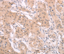 Invitrogen ADAM11 Polyclonal Antibody 100 &mu;L; Unconjugated:Antibodies,