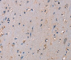Invitrogen ADAM29 Polyclonal Antibody 100 &mu;L; Unconjugated:Antibodies,