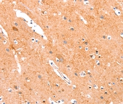 Invitrogen ANKZF1 Polyclonal Antibody 100 &mu;L; Unconjugated:Antibodies,
