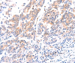 Invitrogen ANKZF1 Polyclonal Antibody 100 &mu;L; Unconjugated:Antibodies,