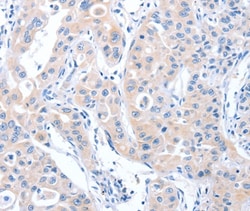 ARHGEF6 Polyclonal Antibody:Antibodies, Polyclonal