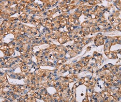 Invitrogen ARAP1 Polyclonal Antibody 100 &mu;L | Buy Online | Invitrogen&trade; | Fisher Scientific