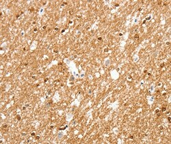 Invitrogen AMZ1 Polyclonal Antibody 100 &mu;L; Unconjugated:Antibodies,