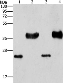 Invitrogen LIN28B Polyclonal Antibody 100 &mu;L; Unconjugated:Antibodies,