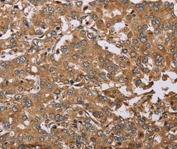 DDAH1 Polyclonal Antibody:Antibodies, Polyclonal